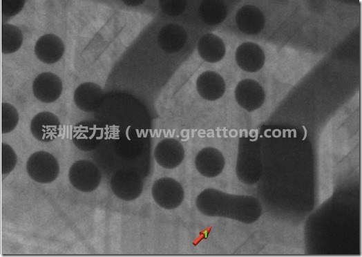 BGA因為焊墊變小，造成錫膏過多而最終形成焊接短路的結(jié)果。
